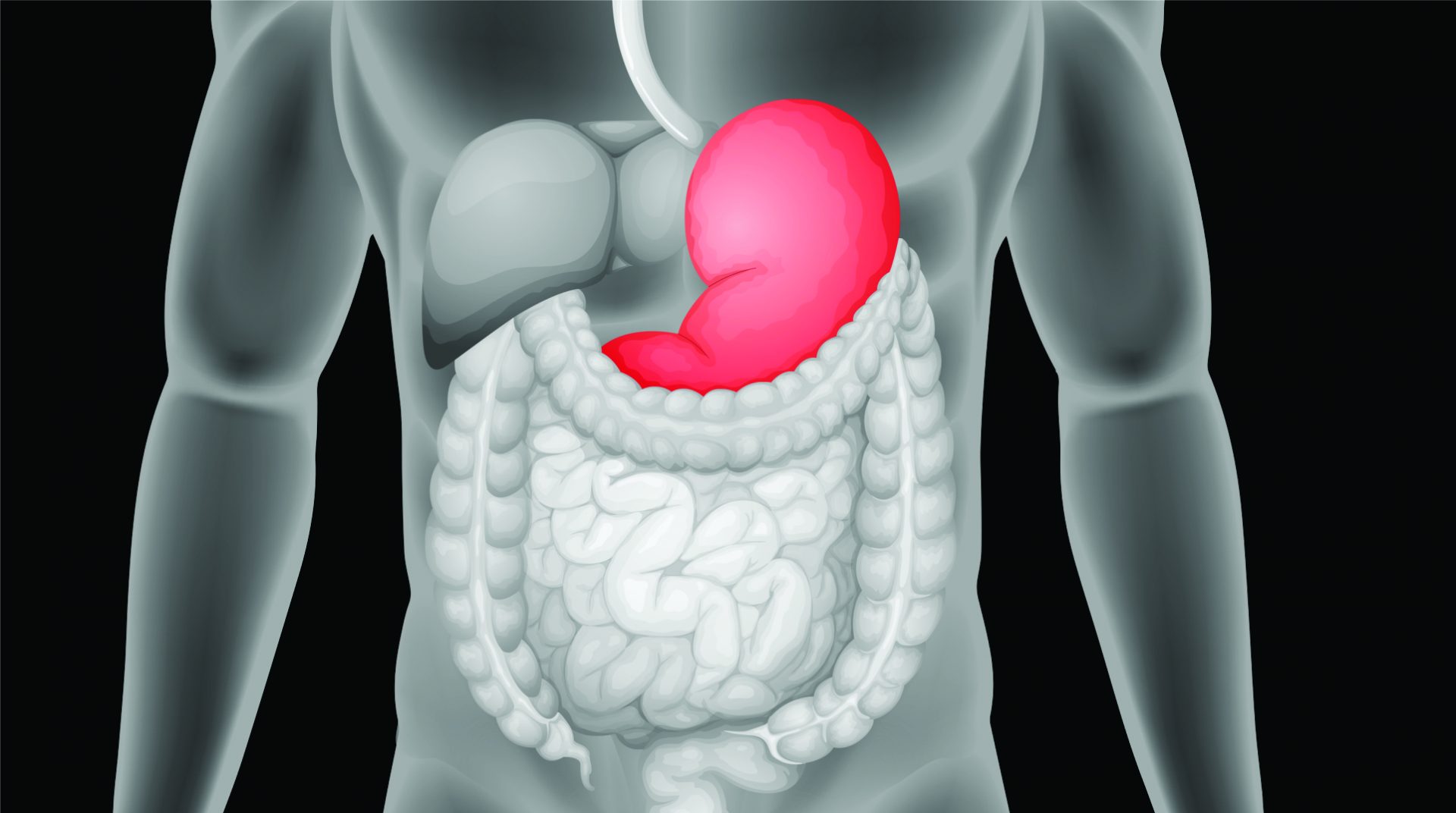 MICROBIOMA INTESTINAL - Laboratório Lustosa