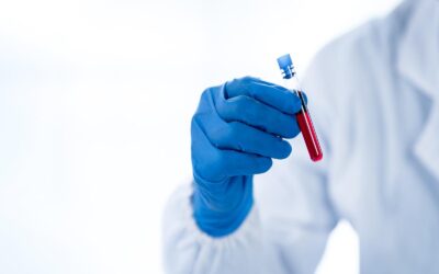 Hiv / Aids: Exames Laboratoriais Permitem Diagnóstico Assertivo